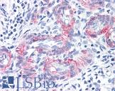 MCAM / CD146 Antibody - Anti-MCAM / CD146 antibody IHC of human vessels in human uterus. Immunohistochemistry of formalin-fixed, paraffin-embedded tissue after heat-induced antigen retrieval. Antibody concentration 20 ug/ml.