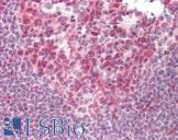 MCL1 / MCL 1 Antibody - Anti-MCL1 / MCL 1 antibody IHC staining of human tonsil. Immunohistochemistry of formalin-fixed, paraffin-embedded tissue after heat-induced antigen retrieval. Antibody concentration 10 ug/ml.