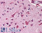 MCL1 / MCL 1 Antibody - Anti-MCL1 antibody IHC of human brain, cortex. Immunohistochemistry of formalin-fixed, paraffin-embedded tissue after heat-induced antigen retrieval. Antibody concentration 2 ug/ml.