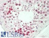 MED1 / TRAP220 Antibody - Human Testis: Formalin-Fixed, Paraffin-Embedded (FFPE)