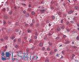 MGLL / Monoacylglycerol Lipase Antibody - Anti-MGLL antibody IHC of human liver. Immunohistochemistry of formalin-fixed, paraffin-embedded tissue after heat-induced antigen retrieval. Antibody concentration 3.75 ug/ml.