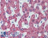 MGST1 Antibody - Human, Liver: Formalin-Fixed, Paraffin-Embedded (FFPE)