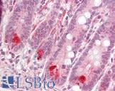 MLIP Antibody - Anti-MLIP antibody IHC staining of human small intestine. Immunohistochemistry of formalin-fixed, paraffin-embedded tissue after heat-induced antigen retrieval.