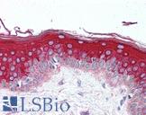 MLST8 / GBL Antibody - Anti-GBL antibody IHC of human skin. Immunohistochemistry of formalin-fixed, paraffin-embedded tissue after heat-induced antigen retrieval. Antibody concentration 10 ug/ml.