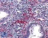 MMP13 Antibody - Anti-MMP13 antibody IHC of human uterus. Immunohistochemistry of formalin-fixed, paraffin-embedded tissue after heat-induced antigen retrieval. Antibody concentration 5 ug/ml.