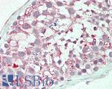 MRGPRX3 / MRGX3 Antibody - Human Testis: Formalin-Fixed, Paraffin-Embedded (FFPE)