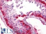 MRPL34 Antibody - Human Testis: Formalin-Fixed, Paraffin-Embedded (FFPE)