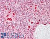 MSH5 Antibody - Anti-MSH5 antibody IHC of human thymus. Immunohistochemistry of formalin-fixed, paraffin-embedded tissue after heat-induced antigen retrieval. Antibody concentration 2.5 ug/ml.