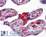 MSX2 / MSH Antibody - Anti-MSX2 antibody IHC of human placenta. Immunohistochemistry of formalin-fixed, paraffin-embedded tissue after heat-induced antigen retrieval. Antibody concentration 5 ug/ml.