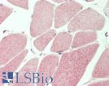 MT-ND5 Antibody - Human Skeletal Muscle: Formalin-Fixed, Paraffin-Embedded (FFPE)