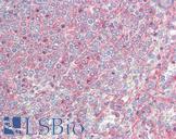 MTCL1 / SOGA2 Antibody - Human Spleen: Formalin-Fixed, Paraffin-Embedded (FFPE)