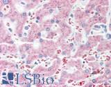 MTTP / MTP Antibody - Human Liver: Formalin-Fixed, Paraffin-Embedded (FFPE)