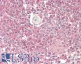 MYO5C Antibody - Human Spleen: Formalin-Fixed, Paraffin-Embedded (FFPE)