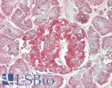 Myosin VI / MYO6 Antibody - Human Pancreas: Formalin-Fixed, Paraffin-Embedded (FFPE)