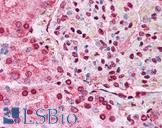 NBN / Nibrin Antibody - Anti-NBN / Nibrin antibody IHC of human kidney. Immunohistochemistry of formalin-fixed, paraffin-embedded tissue after heat-induced antigen retrieval. Antibody concentration 5 ug/ml.
