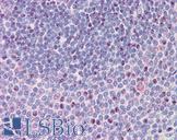 NCOA3 / SRC-3 / AIB1 Antibody - Anti-NCOA3 antibody IHC of human spleen. Immunohistochemistry of formalin-fixed, paraffin-embedded tissue after heat-induced antigen retrieval. Antibody concentration 3.75 ug/ml.