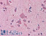 NDN / Necdin Antibody - Anti-NDN / Necdin antibody IHC of human brain, cortex. Immunohistochemistry of formalin-fixed, paraffin-embedded tissue after heat-induced antigen retrieval. Antibody concentration 5 ug/ml.