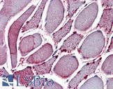 NEK7 Antibody - Anti-NEK7 antibody IHC of human skeletal muscle. Immunohistochemistry of formalin-fixed, paraffin-embedded tissue after heat-induced antigen retrieval.