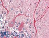 NETO2 Antibody - Human Brain, Cerebellum: Formalin-Fixed, Paraffin-Embedded (FFPE)