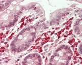 NFATC4 / NFAT3 Antibody - Human Small Intestine: Formalin-Fixed, Paraffin-Embedded (FFPE)