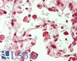 NFIB Antibody - Human Lung: Formalin-Fixed, Paraffin-Embedded (FFPE)