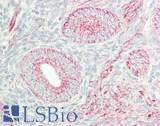 NIP3 / BNIP3 Antibody - Human Uterus: Formalin-Fixed, Paraffin-Embedded (FFPE)