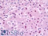 NOC3L Antibody - Anti-NOC3L antibody IHC staining of human liver. Immunohistochemistry of formalin-fixed, paraffin-embedded tissue after heat-induced antigen retrieval. Antibody dilution 1:50.