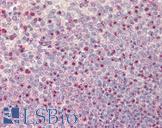 NOD1 Antibody - Anti-NOD1 antibody IHC staining of human spleen. Immunohistochemistry of formalin-fixed, paraffin-embedded tissue after heat-induced antigen retrieval.