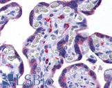 NOD3 / NLRC3 Antibody - Anti-NLRC3 antibody IHC of human placenta. Immunohistochemistry of formalin-fixed, paraffin-embedded tissue after heat-induced antigen retrieval. Antibody concentration 5 ug/ml.