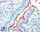NPC1L1 Antibody - Anti-NPC1L1 antibody IHC staining of human small intestine. Immunohistochemistry of formalin-fixed, paraffin-embedded tissue after heat-induced antigen retrieval.