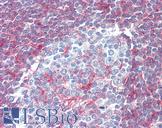 NT5E / eNT / CD73 Antibody - Anti-NT5E / CD73 antibody IHC of human tonsil. Immunohistochemistry of formalin-fixed, paraffin-embedded tissue after heat-induced antigen retrieval. Antibody dilution 1:200.