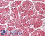 OGT / O-GLCNAC Antibody - Human Pancreas: Formalin-Fixed, Paraffin-Embedded (FFPE)