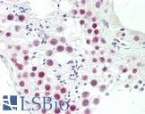 OLIG3 Antibody - Human Testis: Formalin-Fixed, Paraffin-Embedded (FFPE)