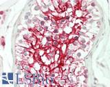 OR4S1 Antibody - Human Testis: Formalin-Fixed, Paraffin-Embedded (FFPE)