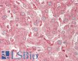 OR8D1 Antibody - Human Liver: Formalin-Fixed, Paraffin-Embedded (FFPE)