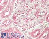 OSBPL2 Antibody - Human Kidney: Formalin-Fixed, Paraffin-Embedded (FFPE)