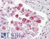 OSBPL9 Antibody - Anti-OSBPL9 antibody IHC of human lung, alveolar macrophages. Immunohistochemistry of formalin-fixed, paraffin-embedded tissue after heat-induced antigen retrieval. Antibody concentration 2.5 ug/ml.