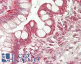 P4HA1 Antibody - Human Small Intestine: Formalin-Fixed, Paraffin-Embedded (FFPE)