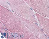 PACE4 / PCSK6 Antibody - Anti-PACE4 antibody IHC of human skeletal muscle. Immunohistochemistry of formalin-fixed, paraffin-embedded tissue after heat-induced antigen retrieval. Antibody concentration 5 ug/ml.