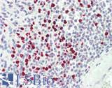 PADI4 / PAD4 Antibody - Human Spleen: Formalin-Fixed, Paraffin-Embedded (FFPE)