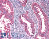 PAICS / ADE2 Antibody - Human Uterus: Formalin-Fixed, Paraffin-Embedded (FFPE)