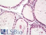 PALB2 Antibody - Human Thyroid: Formalin-Fixed, Paraffin-Embedded (FFPE)