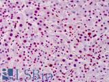 PAR / Poly ADP-Ribose Antibody - Anti-Poly ADP-Ribose antibody IHC of human liver. Immunohistochemistry of formalin-fixed, paraffin-embedded tissue after heat-induced antigen retrieval. Antibody concentration 5 ug/ml.