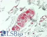 PARD3 Antibody - Human Small Intestine, Submucosal Plexus: Formalin-Fixed, Paraffin-Embedded (FFPE)
