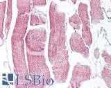 PARG Antibody - Human Skeletal Muscle: Formalin-Fixed, Paraffin-Embedded (FFPE)