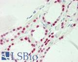 PAX8 Antibody - Human Thyroid: Formalin-Fixed, Paraffin-Embedded (FFPE)