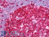 PDCL3 Antibody - Human Tonsil: Formalin-Fixed, Paraffin-Embedded (FFPE) 