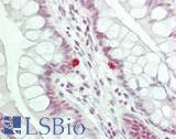 PDS5B / AS3 Antibody - Human Small Intestine: Formalin-Fixed, Paraffin-Embedded (FFPE)