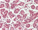 PEX11B Antibody - Human Breast: Formalin-Fixed, Paraffin-Embedded (FFPE)