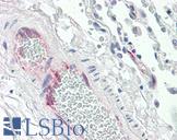 PGIS / PTGIS Antibody - Anti-PTGIS antibody IHC of human lung, vessel. Immunohistochemistry of formalin-fixed, paraffin-embedded tissue after heat-induced antigen retrieval. Antibody concentration 5 ug/ml.
